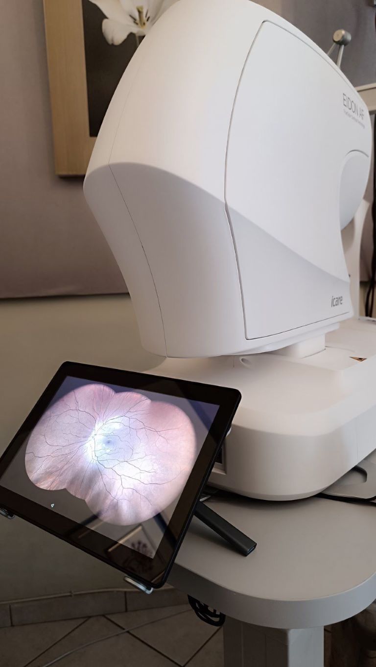 ofthalmologiki-apeikonisi-yper-evreos-pediou-iCare-EIDON-AF Σύγχρονο διαγνωστικό μηχάνημα iCare EIDON AF για απεικόνιση υπερ-ευρέως πεδίου και αυτοφθορισμό αμφιβληστροειδούς.